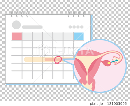 日曆標有不孕不育治療、不孕不育、計時方法 121003996