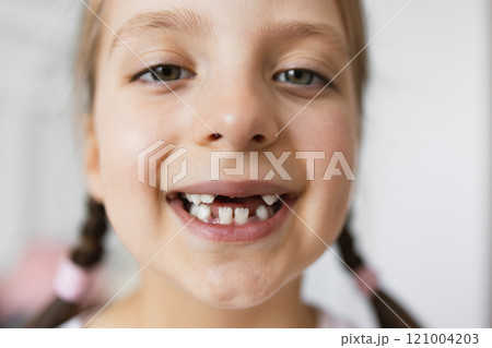 Portrait of young Caucasian girl with missing teeth from falling out baby teeth. She smiles happily with braided hair, conveying childhood innocence and joy, captured in a home environment. 121004203