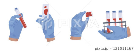 Blood tube analysis. Bloods filling glass vial tubes in nurse hands gloves for medical hiv or diabetes test, biochemistry chemical lab experience testing vector illustration Blood tube analysis. Bloods filling glass vial tubes in nurse hands gloves for medical hiv or diabetes test, biochemistry chemical lab experience testing vector illustration 121011167