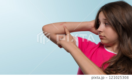 Girl pointing to scrape on arm 121025308
