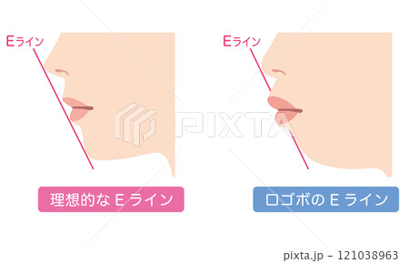 理想的なEラインと 口ゴボのEライン 横顔 理想的なEラインと 口ゴボのEライン 横顔 121038963