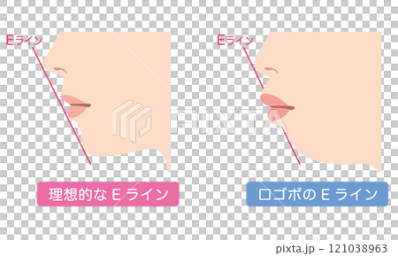 理想的なEラインと 口ゴボのEライン 横顔 理想的なEラインと 口ゴボのEライン 横顔 121038963
