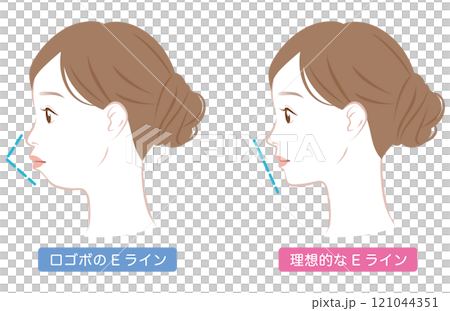 Ideal E-line and protruding E-line profile Ideal E-line and protruding E-line profile 121044351