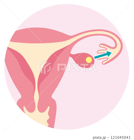 排卵する卵巣　不妊治療　不妊症　タイミング法 121045041