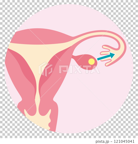 排卵する卵巣　不妊治療　不妊症　タイミング法 121045041