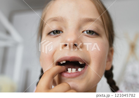 Close-up portrait of young Caucasian girl showing missing baby teeth, smiling proudly. She is at home, displaying natural tooth gaps, symbolizing childhood milestones. Close-up portrait of young Caucasian girl showing missing baby teeth, smiling proudly. She is at home, displaying natural tooth gaps, symbolizing childhood milestones. 121045782