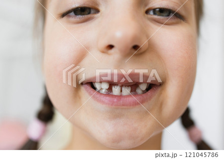 Portrait of smiling Caucasian girl with missing teeth, showing gap from falling out baby teeth at home. Brown hair in pigtails, representing childhood and tooth loss. 121045786