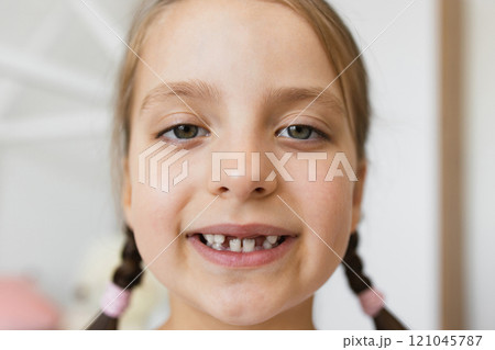 Close-up of smiling Caucasian girl with brown hair and braided pigtails, showing gaps from missing baby teeth, in a bright home setting. 121045787