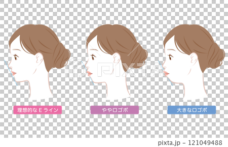 Ideal E-line and protruding E-line profile Ideal E-line and protruding E-line profile 121049488