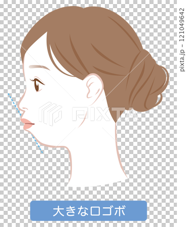 Large protruding mouth with an E-line profile 121049642
