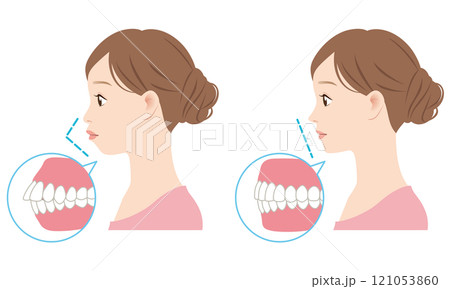 理想的なEラインと　口ゴボのEライン　横顔 121053860