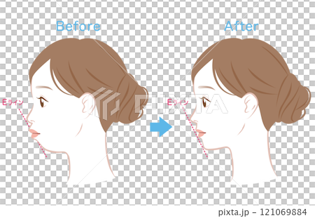 Ideal E-line and protruding E-line profile Ideal E-line and protruding E-line profile 121069884