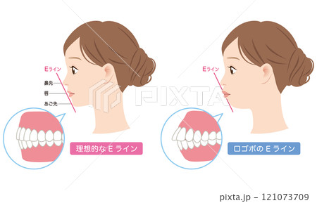 理想的なEラインと　口ゴボのEライン　横顔 121073709
