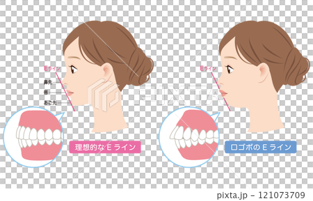 Ideal E-line and protruding E-line profile Ideal E-line and protruding E-line profile 121073709