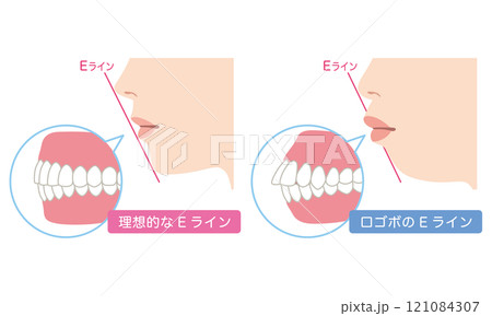 理想的なEラインと 口ゴボのEライン 横顔 理想的なEラインと 口ゴボのEライン 横顔 121084307