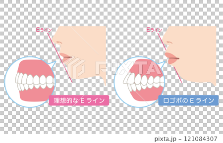 理想的なEラインと 口ゴボのEライン 横顔 理想的なEラインと 口ゴボのEライン 横顔 121084307