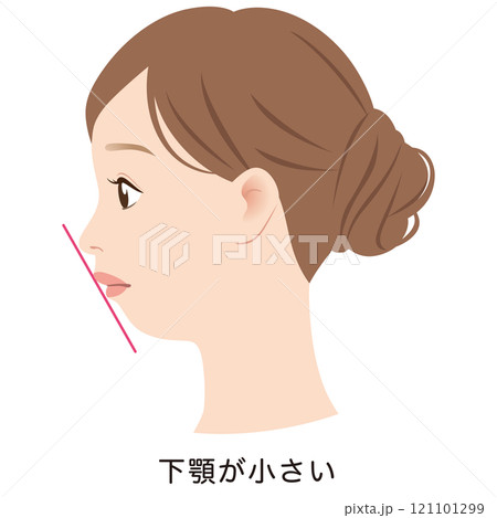 下顎が小さい口元　アデノイド顔貌　Eライン　横顔 121101299