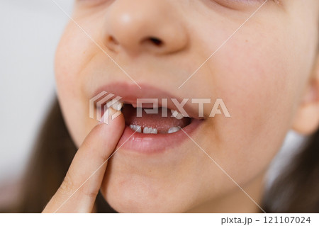 Little Caucasian girl proudly shows her fallen baby tooth, pointing at gap in her smile at home. 121107024