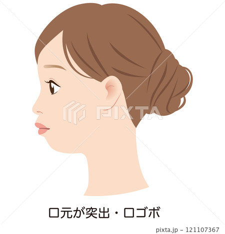 突出した口元 口ゴボのEライン 横顔 突出した口元 口ゴボのEライン 横顔 121107367