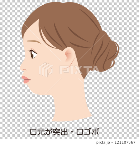 突出した口元 口ゴボのEライン 横顔 突出した口元 口ゴボのEライン 横顔 121107367