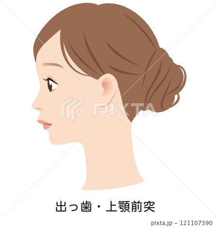 上顎突出の口元　出っ歯　Eライン　横顔 121107390