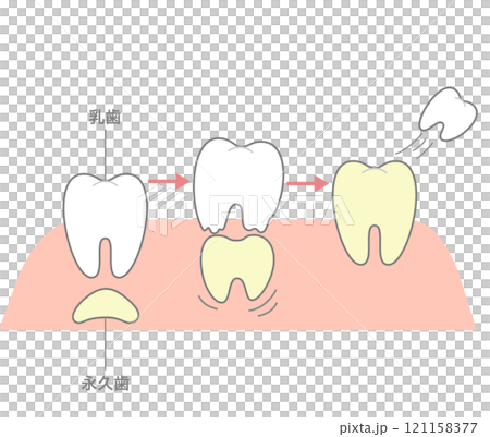 Permanent teeth dissolve and push out baby teeth to replace them Permanent teeth dissolve and push out baby teeth to replace them 121158377
