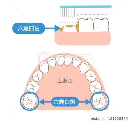 歯ブラシで磨きにくい6才臼歯の段差と歯磨き 121158379