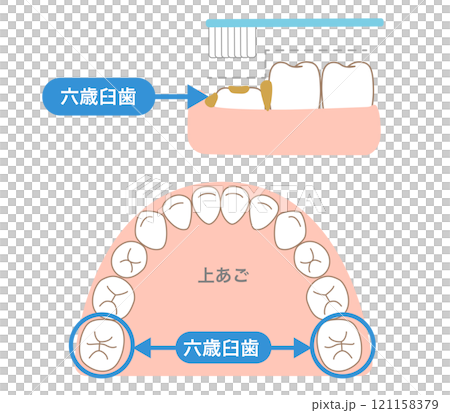 歯ブラシで磨きにくい6才臼歯の段差と歯磨き 121158379