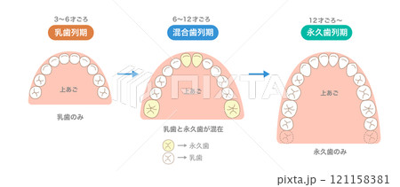 年齢で変化する歯の本数と新しく生える歯と歯並び 年齢で変化する歯の本数と新しく生える歯と歯並び 121158381