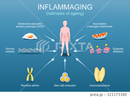 Inflammaging. Hallmarks of ageing. Chronic inflammation Inflammaging. Hallmarks of ageing. Chronic inflammation 121173380