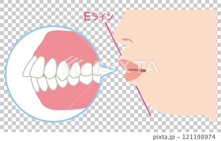 牙齒突出、E線突出、矯正 牙齒突出、E線突出、矯正 121198974