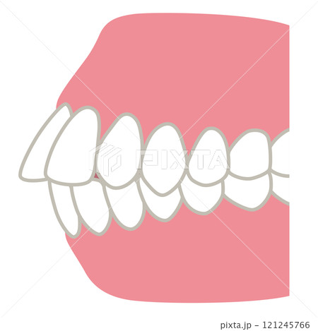 歯が出た歯並び 口ゴボ 歯列矯正 歯が出た歯並び 口ゴボ 歯列矯正 121245766