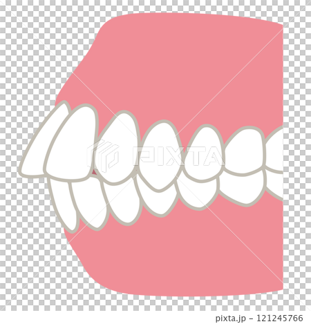 歯が出た歯並び 口ゴボ 歯列矯正 歯が出た歯並び 口ゴボ 歯列矯正 121245766