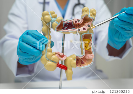 Intestine, doctor holding human anatomy model for study diagnosis and treatment in hospital. 121260236