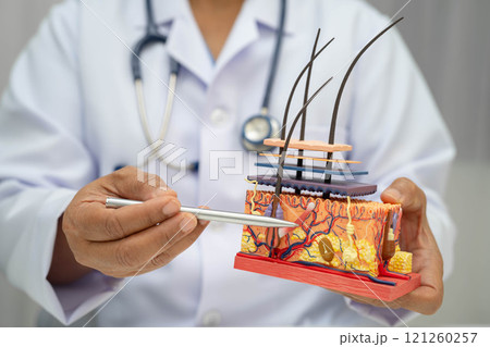 Hair transplant, Asian dermatologist doctor holding skin structure anatomy model for treatment in hospital. 121260257