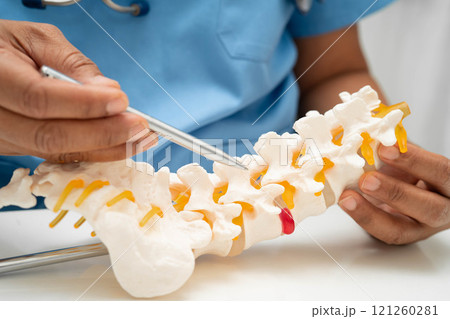 Asian doctor holding spinal nerve and bone model, Lumbar spine displaced herniated disc fragment for treatment medical in the orthopedic department. Asian doctor holding spinal nerve and bone model, Lumbar spine displaced herniated disc fragment for treatment medical in the orthopedic department. 121260281