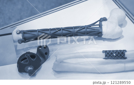 Implants and prostheses printed on 3D printer from biocompatible titanium powder. Implant replacement of tubular bones on white human bone printed on 3D printer. Implant hip joints. Endoprostheses 121289550
