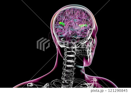Human brain with highlighted transverse temporal gyri, 3D illustration Human brain with highlighted transverse temporal gyri, 3D illustration 121290845