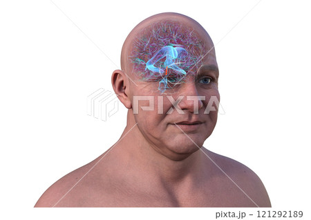 Human brain with the cerebral aqueduct and the ventricular system, 3D illustration 121292189