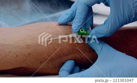 Surgeon in blue surgical gloves inserting an intravenous catheter into a patient's arm before surgery in a sterile operating room 121301047