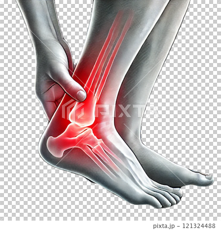 足首を痛めているイラスト 121324488