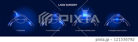 LASIK eye surgery 121330792