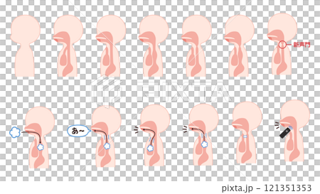 Illustration set of cross sections of the body related to esophageal speech 121351353
