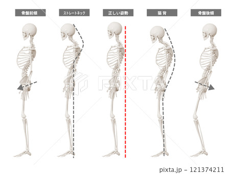 姿勢比較イラスト 骨格模型 全身横向き 猫背 ストレートネック 骨盤前傾後傾 121374211