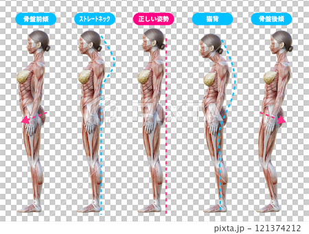 Female muscle anatomy, posture comparison, hunchback, straight neck, forward and backward pelvic tilt, sideways, whole body Female muscle anatomy, posture comparison, hunchback, straight neck, forward and backward pelvic tilt, sideways, whole body 121374212
