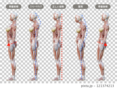 Comparison illustration of female postures (sideways, whole body) Muscle anatomy of pelvic tilt, hunchback, and straight neck 121374213