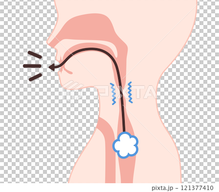 食道発声の仕組みのイラスト 食道発声の仕組みのイラスト 121377410