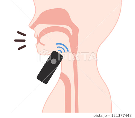 喉頭癌の手術後に電気喉頭で発声するイラスト 121377448