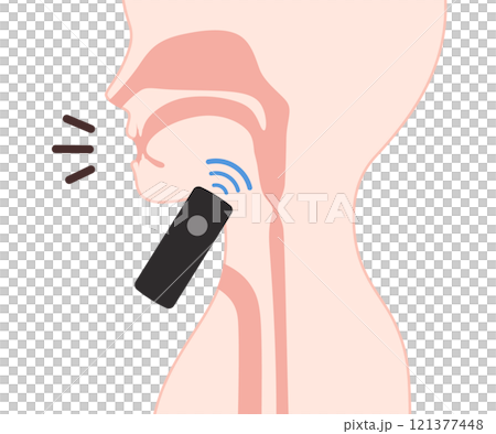 喉頭癌の手術後に電気喉頭で発声するイラスト 121377448