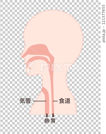 喉癌術後氣管食道圖解 喉癌術後氣管食道圖解 121377655